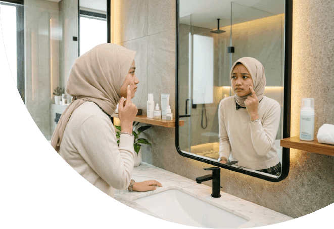 Mengapa Jerawat Muncul Meski Wajah Sudah Dibersihkan? 