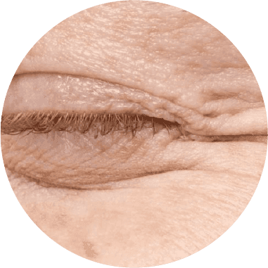 Wajah Kusam Saat Puasa? Jangan Salah, Ini Penyebab Utamanya