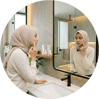 Mengapa Jerawat Muncul Meski Wajah Sudah Dibersihkan?