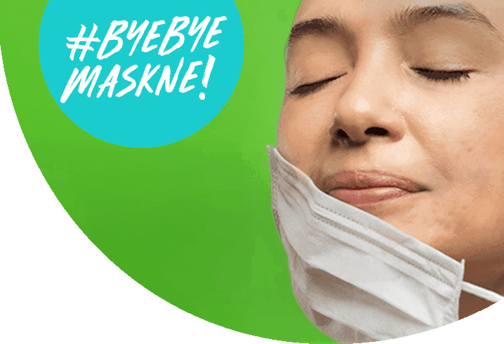 Apa Itu Maskne dan Bagaimana Mencegahnya?